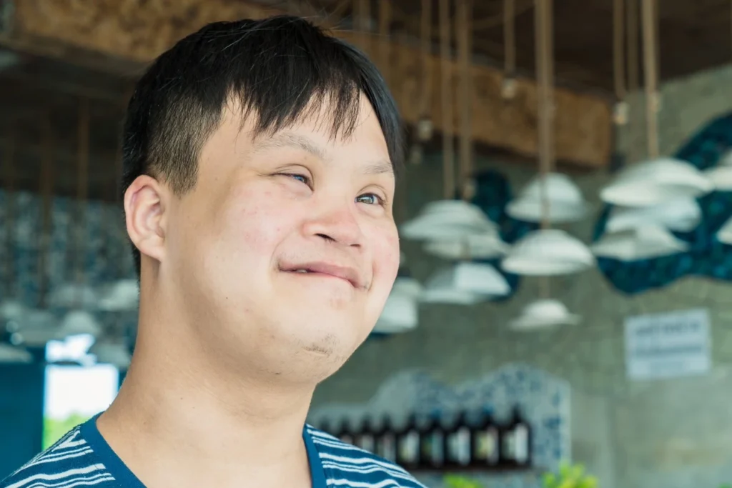 Boy with down syndrome smiling